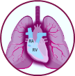 Image of the lungs depicting hypoxemia