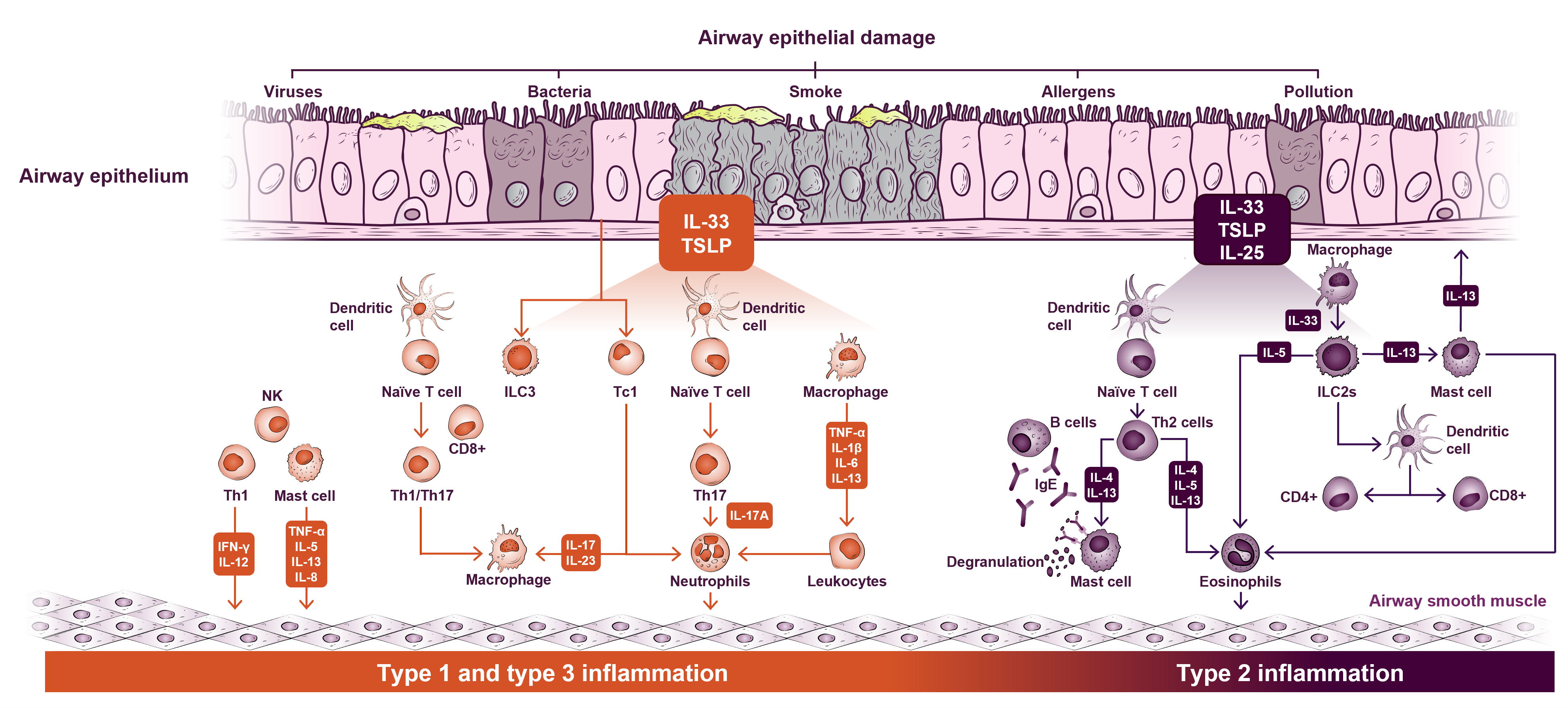 Diagram of Type 1, 2, and 3 inflammation depicting triggers, cytokines, and inflammatory cells