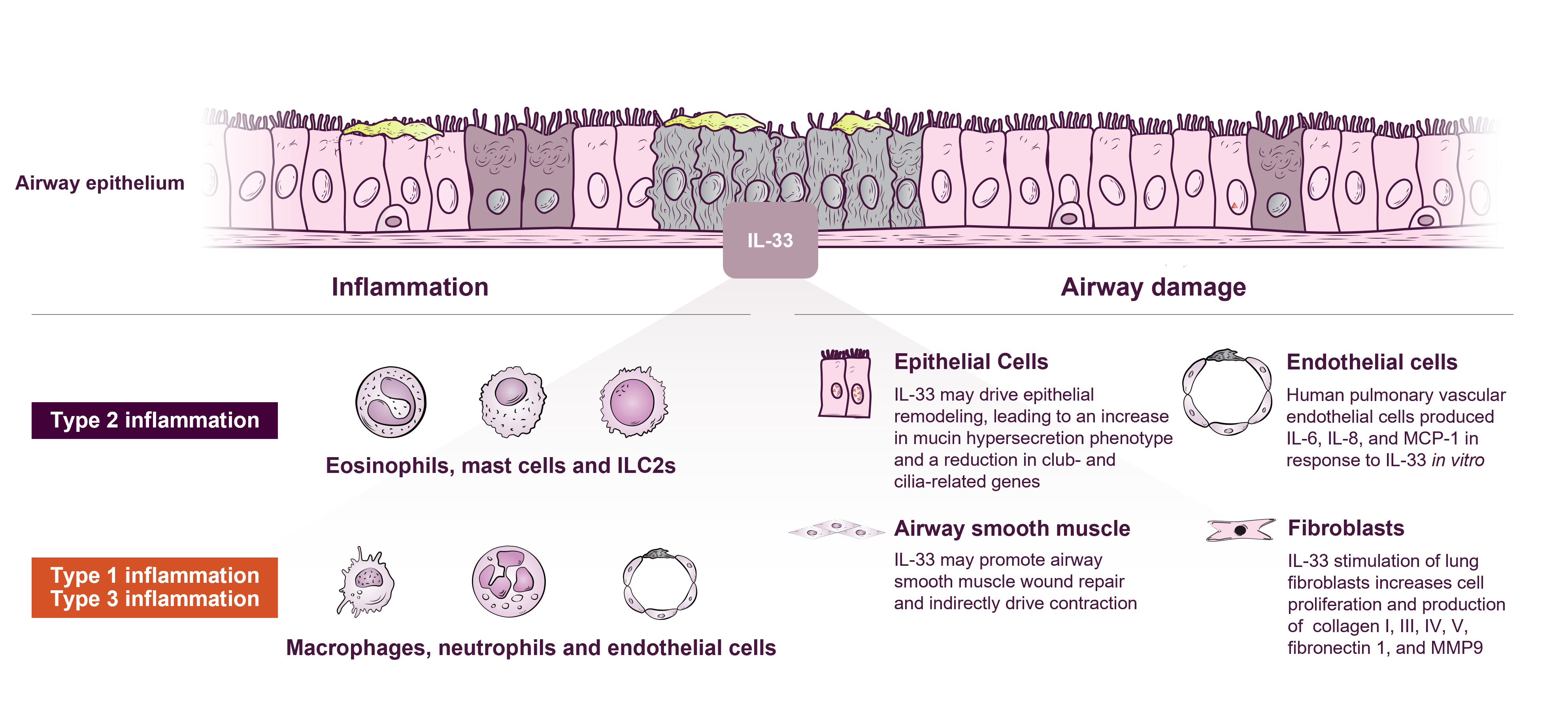 Diagram of IL-33, type 2 inflammation, type 1 and 3 inflammation, and airway damage