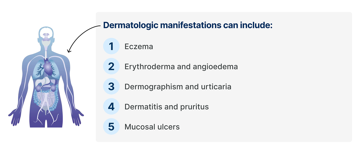 Dermatologic manifestations 