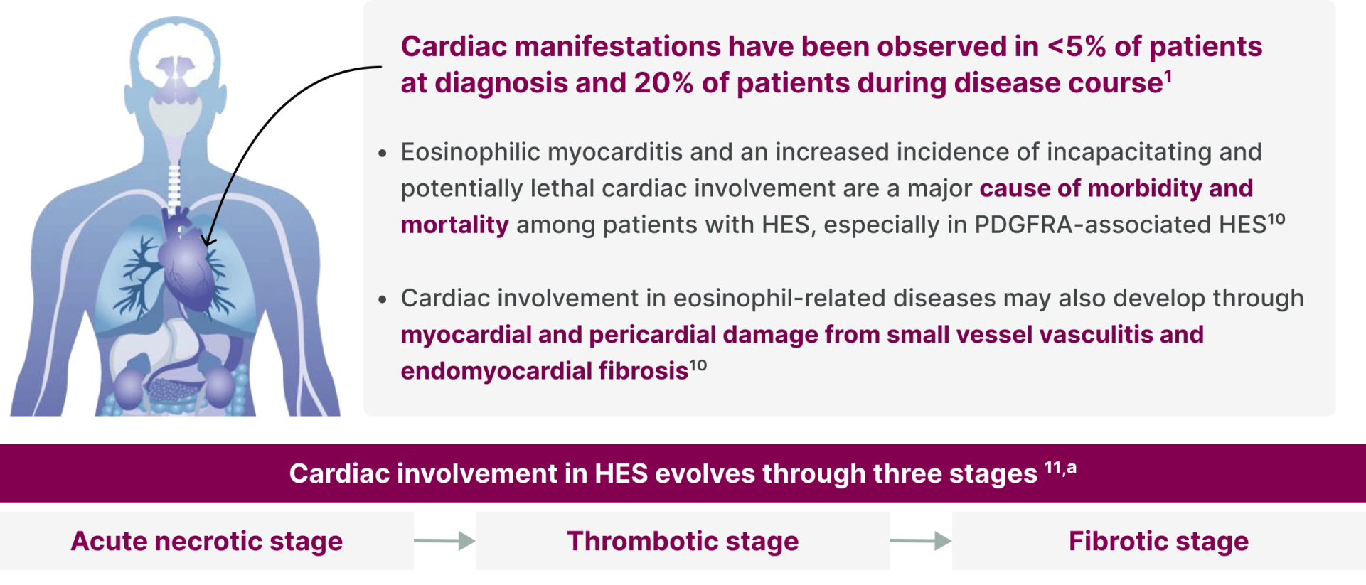 Cardiac manifestations